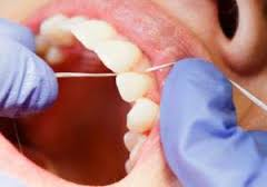 hygienist_services